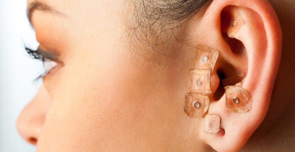 Paciente de olhos fechados recebendo auriculoterapia, representando seus efeitos no bem-estar emocional.
