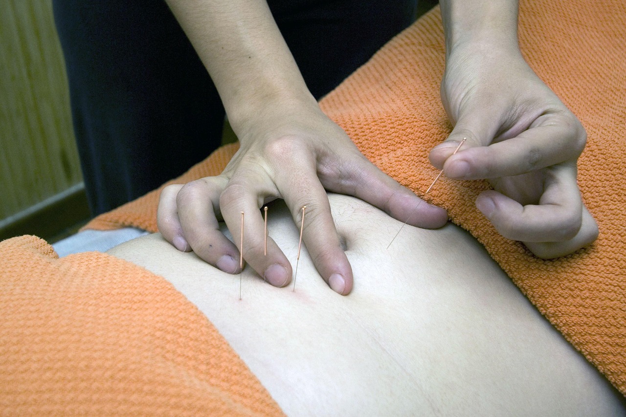 acupuntura para emagrecer