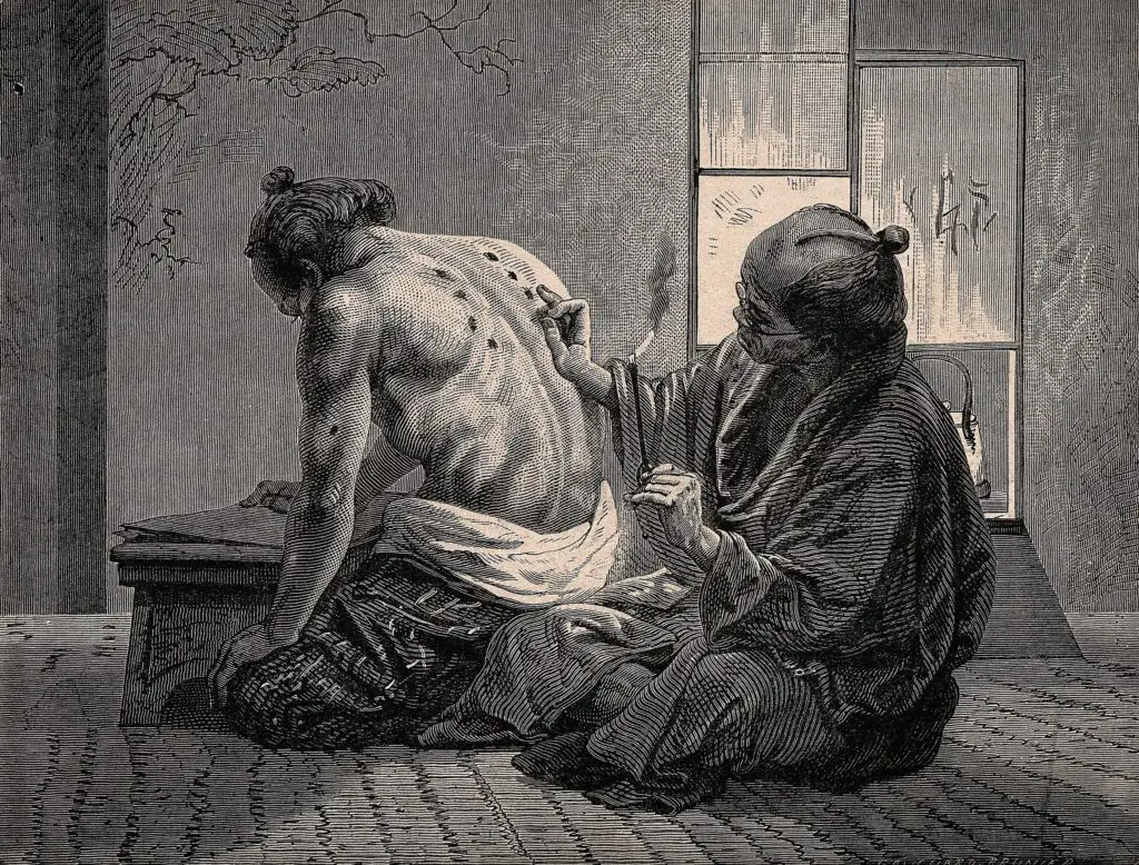 historia da acupuntura